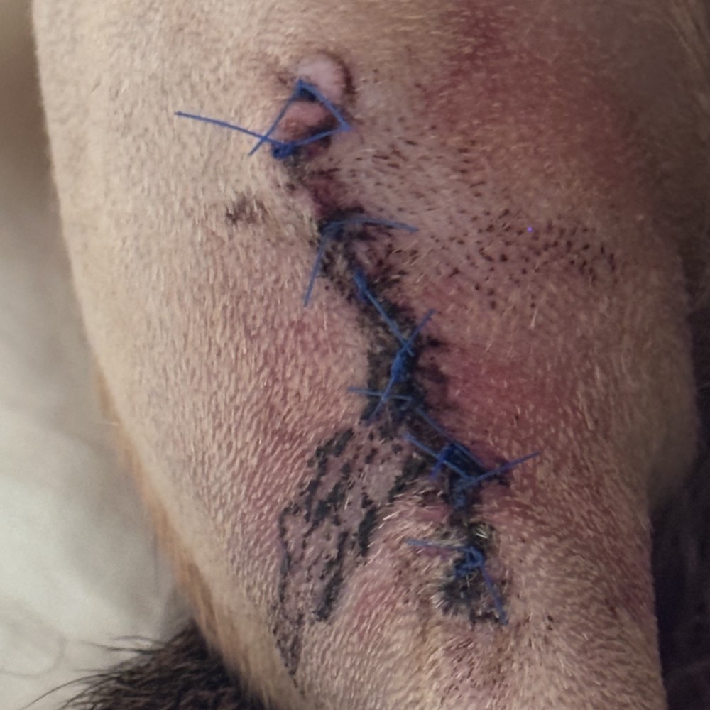 Wylie's surgical site on day 1 of recovery