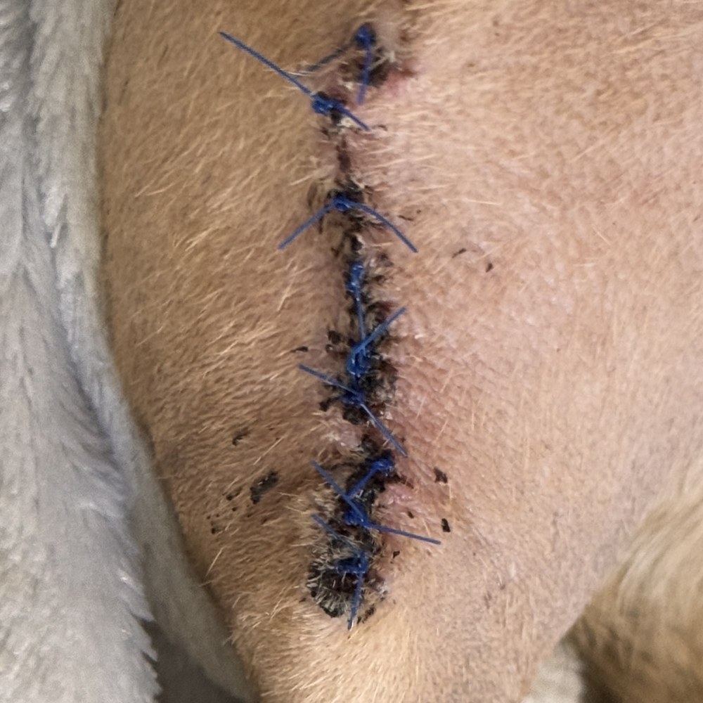 Wylie's surgical site on day 10 of recovery